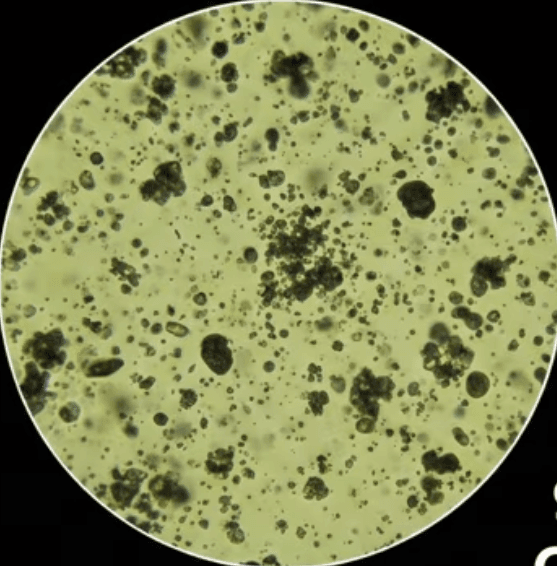 Microscopic oil sample before filtration—heavy particle contamination visible